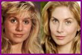 Elizabeth Mitchell Plastic Surgery Before and After