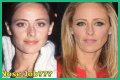 Kim Raver Plastic Surgery Before and After