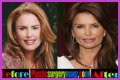 Roma Downey Plastic Surgery Before and After