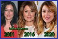 Sasha Alexander Plastic Surgery Before and After